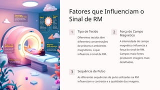 Fatores que Influenciam o
Sinal de RM
1 Tipo de Tecido
Diferentes tecidos têm
diferentes concentrações
de prótons e ambientes
magnéticos, o que
influencia o sinal de RM.
2 Força do Campo
Magnético
A intensidade do campo
magnético influencia a
força do sinal de RM.
Campos mais fortes
produzem imagens mais
detalhadas.
3 Sequência de Pulso
As diferentes sequências de pulso utilizadas na RM
influenciam o contraste e a qualidade das imagens.
 