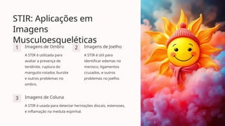 STIR: Aplicações em
Imagens
Musculoesqueléticas
1 Imagens de Ombro
A STIR é utilizada para
avaliar a presença de
tendinite, ruptura do
manguito rotador, bursite
e outros problemas no
ombro.
2 Imagens de Joelho
A STIR é útil para
identificar edemas no
menisco, ligamentos
cruzados, e outros
problemas no joelho.
3 Imagens de Coluna
A STIR é usada para detectar herniações discais, estenoses,
e inflamação na medula espinhal.
 