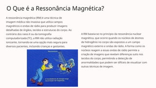 O Que é a Ressonância Magnética?
A ressonância magnética (RM) é uma técnica de
imagem médica não invasiva que utiliza campos
magnéticos e ondas de rádio para produzir imagens
detalhadas de órgãos, tecidos e estruturas do corpo. Ao
contrário dos raios-X ou da tomografia
computadorizada (TC), a RM não utiliza radiação
ionizante, tornando-se uma opção mais segura para
diversos pacientes, incluindo crianças e gestantes.
A RM baseia-se no princípio da ressonância nuclear
magnética, que ocorre quando os núcleos de átomos
de hidrogênio no corpo são expostos a um campo
magnético externo e ondas de rádio. A forma como os
núcleos reagem a essas ondas de rádio permite a
criação de imagens que revelam diferenças sutis nos
tecidos do corpo, permitindo a detecção de
anormalidades que podem ser difíceis de visualizar com
outras técnicas de imagem.
 
