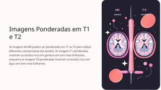 Imagens Ponderadas em T1
e T2
As imagens de RM podem ser ponderadas em T1 ou T2 para realçar
diferentes características dos tecidos. As imagens T1-ponderadas
mostram os tecidos ricos em gordura em tons mais brilhantes,
enquanto as imagens T2-ponderadas mostram os tecidos ricos em
água em tons mais brilhantes.
 