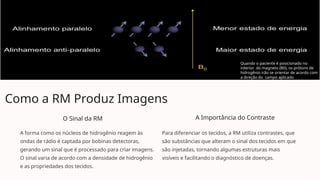 Como a RM Produz Imagens
O Sinal da RM
A forma como os núcleos de hidrogênio reagem às
ondas de rádio é captada por bobinas detectoras,
gerando um sinal que é processado para criar imagens.
O sinal varia de acordo com a densidade de hidrogênio
e as propriedades dos tecidos.
A Importância do Contraste
Para diferenciar os tecidos, a RM utiliza contrastes, que
são substâncias que alteram o sinal dos tecidos em que
são injetadas, tornando algumas estruturas mais
visíveis e facilitando o diagnóstico de doenças.
Quando o paciente é posicionado no
interior do magneto (B0), os prótons de
hidrogênio irão se orientar de acordo com
a direção do campo aplicado
 