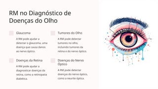 RM no Diagnóstico de
Doenças do Olho
Glaucoma
A RM pode ajudar a
detectar o glaucoma, uma
doença que causa danos
ao nervo óptico.
Tumores do Olho
A RM pode detectar
tumores no olho,
incluindo tumores da
retina e do nervo óptico.
Doenças da Retina
A RM pode ajudar a
diagnosticar doenças da
retina, como a retinopatia
diabética.
Doenças do Nervo
Óptico
A RM pode detectar
doenças do nervo óptico,
como a neurite óptica.
 