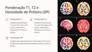 Ponderação T1, T2 e
Densidade de Prótons (DP)
1 Ponderação T1
Imagens de ponderação
T1 usam TRs curtos e TEs
curtos, enfatizando a
diferença de T1 entre os
tecidos.
2 Ponderação T2
Imagens de ponderação
T2 usam TRs longos e TEs
longos, enfatizando a
diferença de T2 entre os
tecidos.
3 Ponderação DP
Imagens de ponderação DP usam TRs longos e TEs curtos,
enfatizando a diferença de densidade de prótons entre os
tecidos.
 