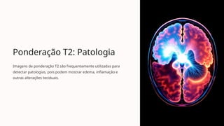 Ponderação T2: Patologia
Imagens de ponderação T2 são frequentemente utilizadas para
detectar patologias, pois podem mostrar edema, inflamação e
outras alterações teciduais.
 