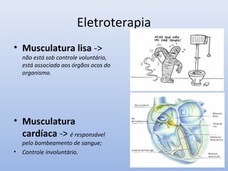 Eletroterapia
• Musculatura lisa ->
não está sob controle voluntário,
está associada aos órgãos ocos do
organismo.
• Musculatura
cardíaca -> é responsável
pelo bombeamento de sangue;
• Controle involuntário.
 