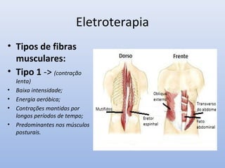 Eletroterapia
• Tipos de fibras
musculares:
• Tipo 1 -> (contração
lenta)
• Baixa intensidade;
• Energia aeróbica;
• Contrações mantidas por
longos períodos de tempo;
• Predominantes nos músculos
posturais.
 