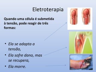 Eletroterapia
• Ela se adapta a
tensão,
• Ela sofre dano, mas
se recupera,
• Ela morre.
Quando uma célula é submetida
à tensão, pode reagir de três
formas:
 
