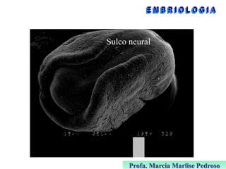 Sulco neural

Profa. Marcia Marlise Pedroso

 