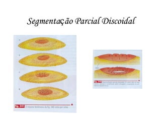 Segmentação Parcial Discoidal

 