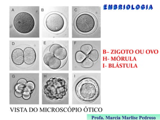 B– ZIGOTO OU OVO
H- MÓRULA
I- BLÁSTULA

VISTA DO MICROSCÓPIO ÓTICO
Profa. Marcia Marlise Pedroso

 