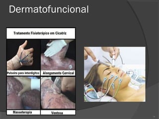 Dermatofuncional
14
 