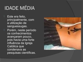 IDADE MÉDIA
 Este era feito,
principalmente, com
a utilização de
sanguessugas.
 Porém, neste período
os conhecimentos
avançaram pouco,
pois havia uma forte
influência da Igreja
Católica que
condenava as
pesquisas científicas.
70
 