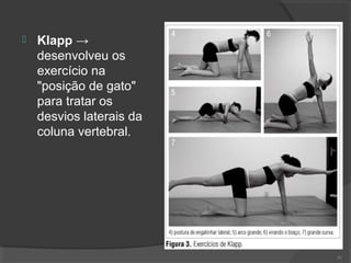  Klapp →
desenvolveu os
exercício na
"posição de gato"
para tratar os
desvios laterais da
coluna vertebral.
91
 