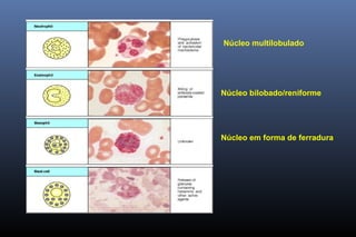 Núcleo bilobado/reniforme
Núcleo multilobulado
Núcleo em forma de ferradura
 