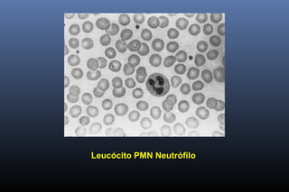 Leucócito PMN Neutrófilo
 