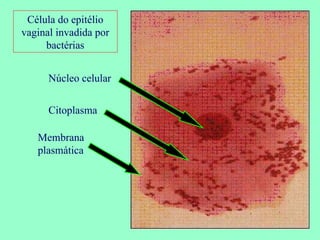 Célula do epitélio vaginal invadida por bactérias Núcleo celular Citoplasma Membrana plasmática 