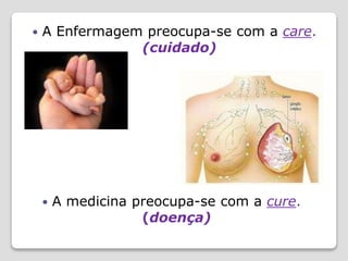  A Enfermagem preocupa-se com a care.
(cuidado)
 A medicina preocupa-se com a cure.
(doença)
 