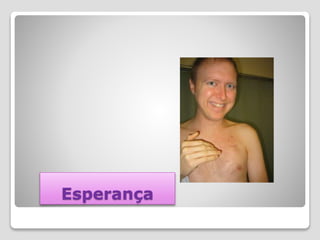 Esperança
 