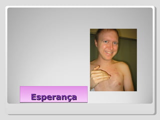 Esperança 