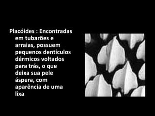Placóides : Encontradas
em tubarões e
arraias, possuem
pequenos dentículos
dérmicos voltados
para trás, o que
deixa sua pele
áspera, com
aparência de uma
lixa
 