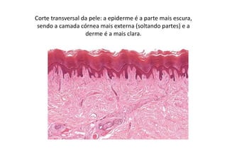 Corte transversal da pele: a epiderme é a parte mais escura,
sendo a camada córnea mais externa (soltando partes) e a
derme é a mais clara.
 