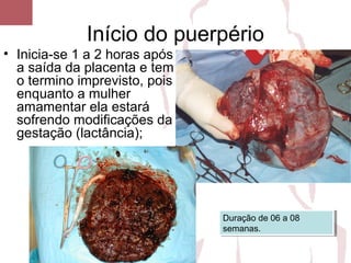 Início do puerpério
• Inicia-se 1 a 2 horas após
a saída da placenta e tem
o termino imprevisto, pois
enquanto a mulher
amamentar ela estará
sofrendo modificações da
gestação (lactância);
Duração de 06 a 08
semanas.
Duração de 06 a 08
semanas.
 