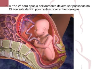 • A 1º e 2º hora após o delivramento devem ser passadas no
CO ou sala de PP, pois podem ocorrer hemorragias;
 