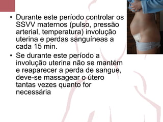 • Durante este período controlar os
SSVV maternos (pulso, pressão
arterial, temperatura) involução
uterina e perdas sanguíneas a
cada 15 min.
• Se durante este período a
involução uterina não se mantém
e reaparecer a perda de sangue,
deve-se massagear o útero
tantas vezes quanto for
necessária
 