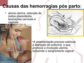 Causas das hemorragias pós parto:
• atonia uterina, retenção de
restos placentários,
lacerações cervicais e
vaginais.
•A amamentação precoce estimula
a liberação de ocitocina, o que
promove a involução uterina,
reduzindo o sangramento vaginal
 