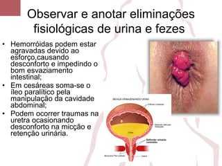 • Hemorróidas podem estar
agravadas devido ao
esforço,causando
desconforto e impedindo o
bom esvaziamento
intestinal;
• Em cesáreas soma-se o
íleo paralítico pela
manipulação da cavidade
abdominal;
• Podem ocorrer traumas na
uretra ocasionando
desconforto na micção e
retenção urinária.
Observar e anotar eliminações
fisiológicas de urina e fezes
 