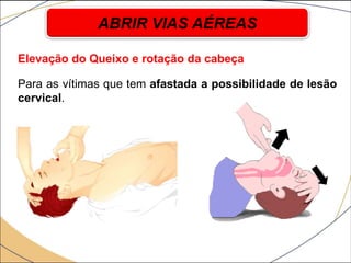 Elevação do Queixo e rotação da cabeça
Para as vítimas que tem afastada a possibilidade de lesão
cervical.
ABRIR VIAS AÉREAS
 
