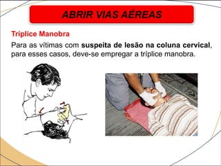 Tríplice Manobra
Para as vítimas com suspeita de lesão na coluna cervical,
para esses casos, deve-se empregar a tríplice manobra.
ABRIR VIAS AÉREAS
 