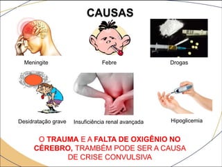 CAUSAS
Meningite Febre Drogas
Desidratação grave Insuficiência renal avançada Hipoglicemia
O TRAUMA E A FALTA DE OXIGÊNIO NO
CÉREBRO, TRAMBÉM PODE SER A CAUSA
DE CRISE CONVULSIVA
 