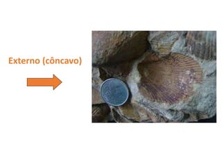Externo (côncavo)
 
