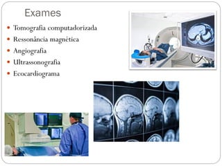 Exames
 Tomografia computadorizada
 Ressonância magnética
 Angiografia
 Ultrassonografia
 Ecocardiograma
 