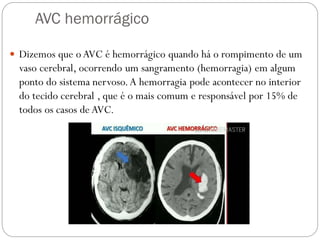 AVC hemorrágico
 Dizemos que o AVC é hemorrágico quando há o rompimento de um
vaso cerebral, ocorrendo um sangramento (hemorragia) em algum
ponto do sistema nervoso.A hemorragia pode acontecer no interior
do tecido cerebral , que é o mais comum e responsável por 15% de
todos os casos de AVC.
 