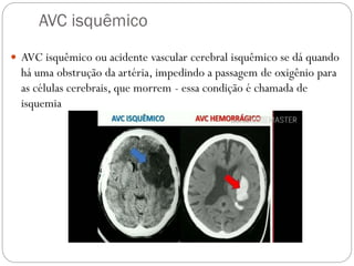 AVC isquêmico
 AVC isquêmico ou acidente vascular cerebral isquêmico se dá quando
há uma obstrução da artéria, impedindo a passagem de oxigênio para
as células cerebrais, que morrem - essa condição é chamada de
isquemia
 