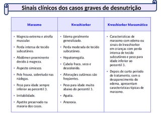 Sinais clínicos dos casos graves de desnutrição
 