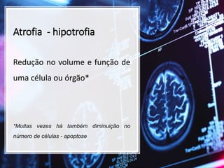 Atrofia - hipotrofia
Redução no volume e função de
uma célula ou órgão*
*Muitas vezes há também diminuição no
número de células - apoptose
 
