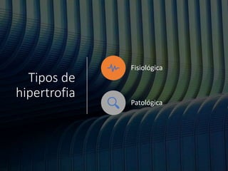 Tipos de
hipertrofia
Fisiológica
Patológica
 