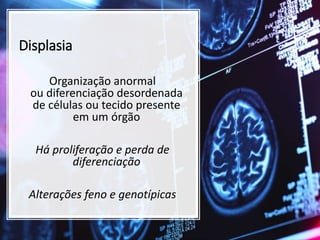 Displasia
Organização anormal
ou diferenciação desordenada
de células ou tecido presente
em um órgão
Há proliferação e perda de
diferenciação
Alterações feno e genotípicas
 