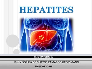 Profa. SORAYA DE MATTOS CAMARGO GROSSMANN
ESTOMATOLOGIA - 2017
HEPATITES
Profa. SORAYA DE MATTOS CAMARGO GROSSMANN
ESTOMATOLOGIA
UNINCOR - 2018
 