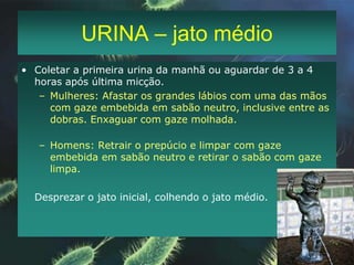 SONDA VESICAL DE DEMORADesinfetar local da coleta com álcool 70%;Pinçar a cânula do coletor;Com seringa e agulha, puncionar a cânula, colher 5-10 ml urina em frasco estéril;