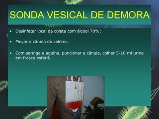 PESQUISA DE BAAR NA URINAHIGIENE PRÉVIACOLETA DE TODA A PRIMEIRA MICÇÃO DA MANHÃCOLETA POR 3 DIAS CONSECUTIVOS