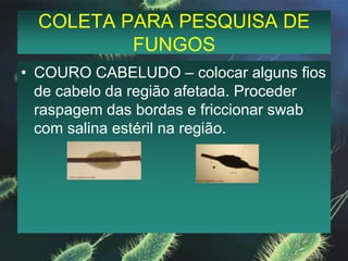 COLETA PARA PESQUISA DE FUNGOSUNHA -  Escovar os pés com água e sabão. Raspar abaixo da unha na região subungueal eliminando regiões externas.