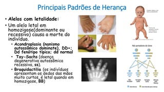 Principais Padrões de Herança
• Alelos com letalidade:
• Um alelo letal em
homozigose(dominante ou
recessivo) causa a morte do
indivíduo.
• Acondroplasia (nanismo
autossômico dominate), DD+;
Dd fenótipo típico; dd normal
• Tay-Sachs (doença
degenerativa autossômica
recessiva, ss).
• Braquidactilia (os indivíduos
apresentam os dedos das mãos
muito curtos, é letal quando em
homozigose, BB)
 