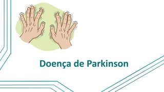 Doença de Parkinson
 