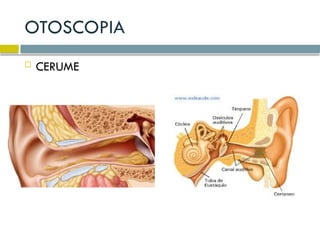 AULA 2 EXAME OTORRINOLARINGOLOGICO 1 pptx aula-2-exame-otorrinolaringologico-1-pptx