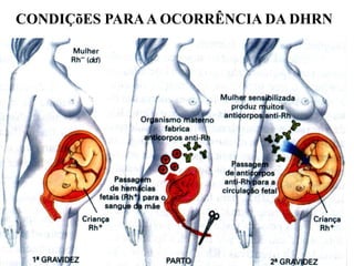 CONDIÇõES PARAA OCORRÊNCIA DA DHRN
 