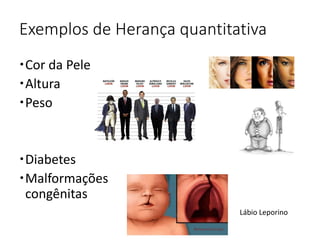 Exemplos de Herança quantitativa
Cor da Pele
Altura
Peso
Diabetes
Malformações
congênitas
Lábio Leporino
 